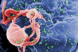 Создана вакцина, защищающая от 30% штаммов ВИЧ