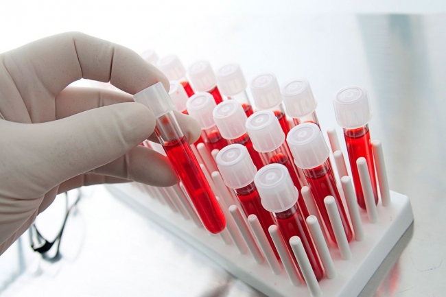 В США разработали новый анализ крови, определяющий 20 типов рака