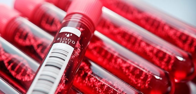 Разработан первый в мире анализ крови на меланому