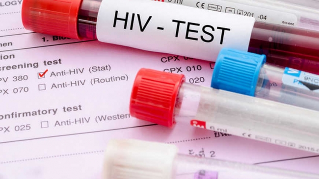 Найден новый способ остановить ВИЧ на ранней стадии