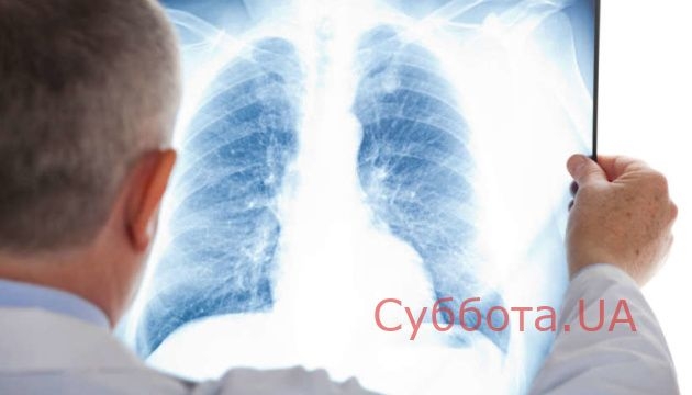 Массовая пневмония в Запорожской области