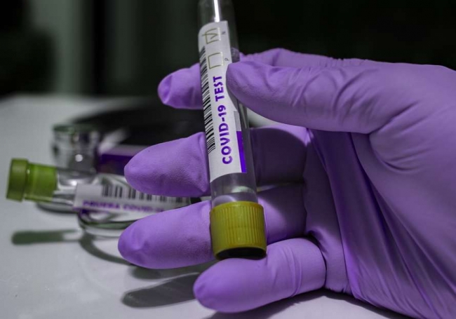 Ученые нашли способ снизить смертность от коронавируса