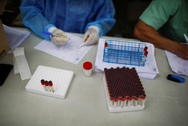 В Украине разрабатывают уникальный тест, который позволит отличить грипп от COVID-19