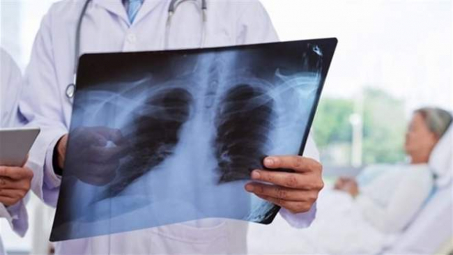 Самые распространённые мифы о здоровье лёгких