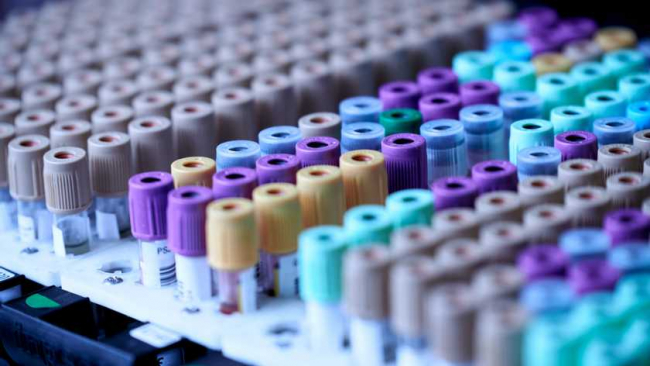 Учёные создали точный и доступный анализ крови на стадию рака