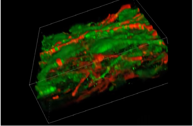 Прорив у медицині: учені створили тканину головного мозку з нейронами за допомогою 3D-друку