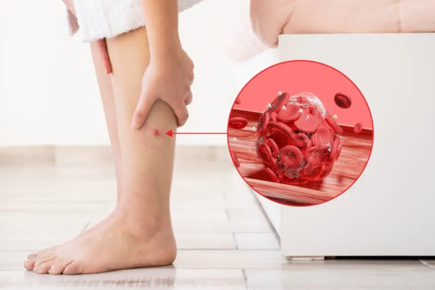 Тромбоз: як розпізнати перші ознаки