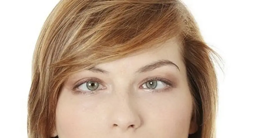 Косоглазие: современные методы лечения