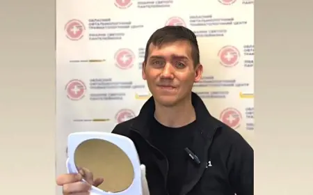 У центрі Unbroken вперше відновили обличчя 35-річному пацієнту з допомогою протеза-накладки