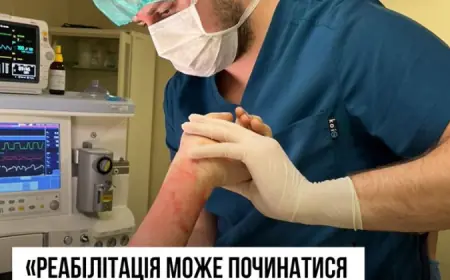 Реабілітація опікових пацієнтів розпочинається просто в операційній
