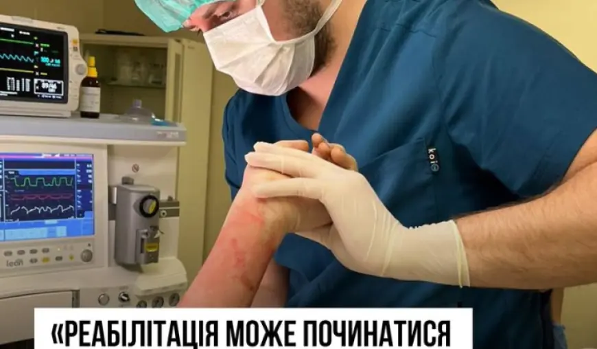 Реабілітація опікових пацієнтів розпочинається просто в операційній